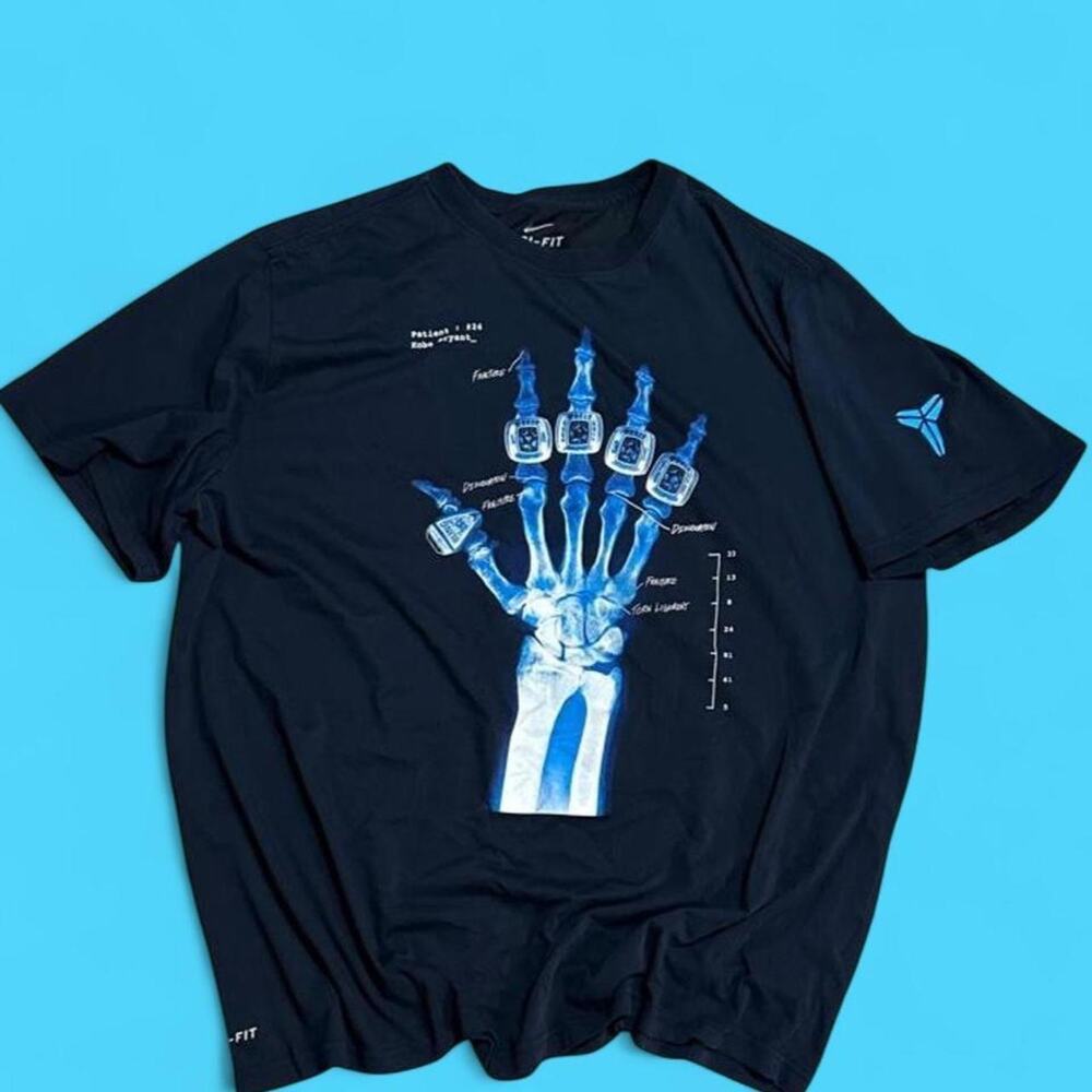 This kobe x ray broken